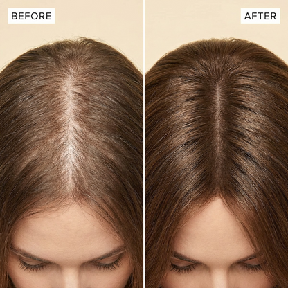 Advanced Hair Growth